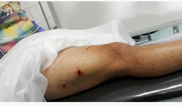 11 de agosto herido de bala